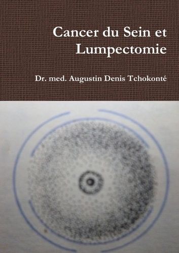 Emprunter Cancer du Sein et Lumpectomie livre