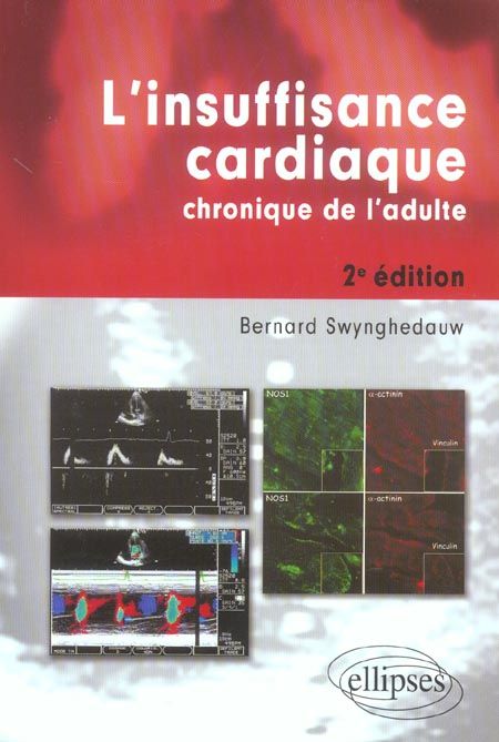 Emprunter L'insuffisance cardiaque chronique de l'adulte. 2e édition livre