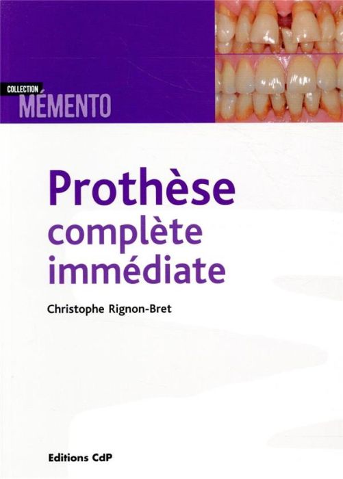 Emprunter Prothèse complète immédiate livre